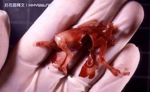 这是一张警惕世人的相片!他是一个刚被妈妈打掉的三个月胎儿!